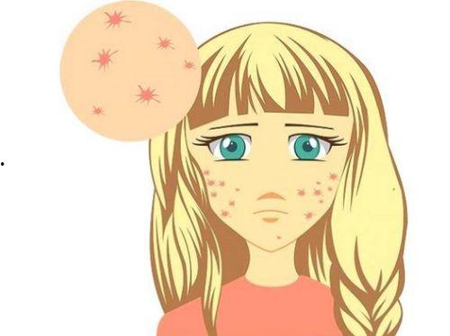 长痘痘吃瓜视频,揭秘痘痘与饮食的奇妙关系