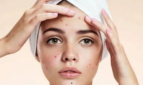 长痘痘吃瓜视频,揭秘痘痘与饮食的奇妙关系